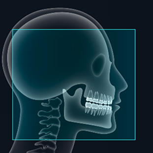 Frontal and lateral view